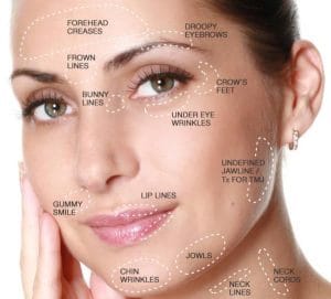 Anti Wrinkle Injectables