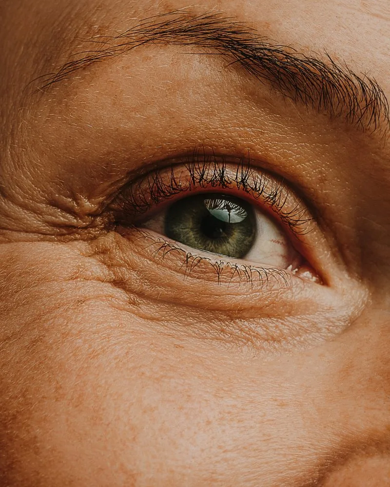 Skin Conditions Skin Conditions