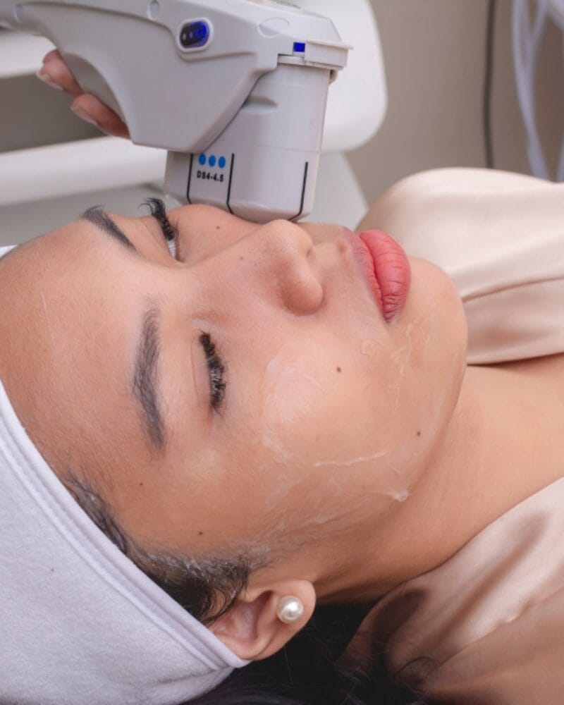 HIFU Skin Tightening