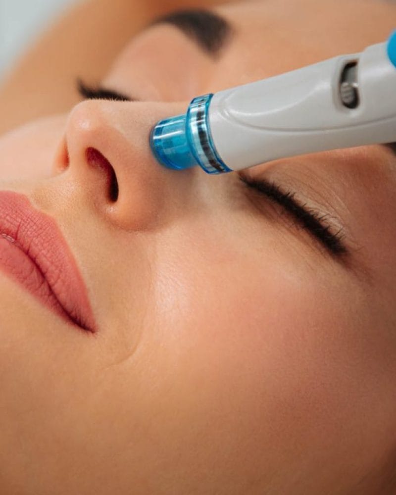Hydrafacial – what do we need to know about this treatment?