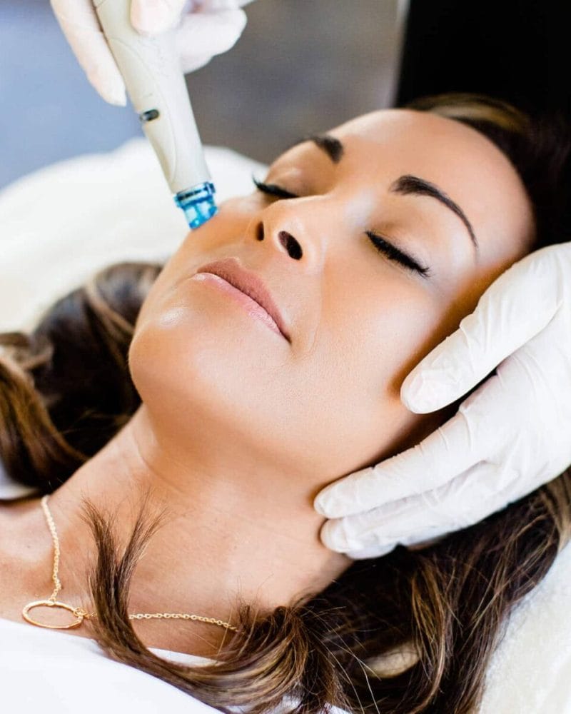 10 reasons why Hydrafacial is so popular