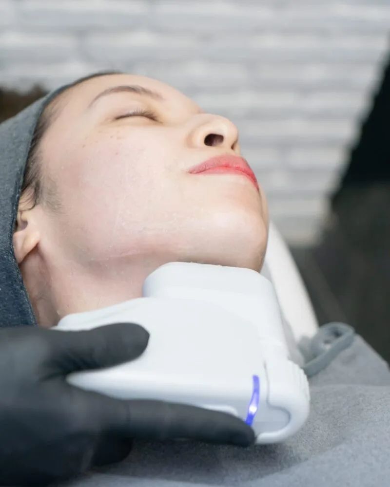 Rejuvenate Your Skin with HIFU: The Latest in Non-Surgical Facelift