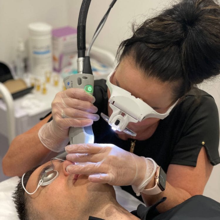 Laser Thread Vein Removal Image 1 Laser Thread Vein Removal