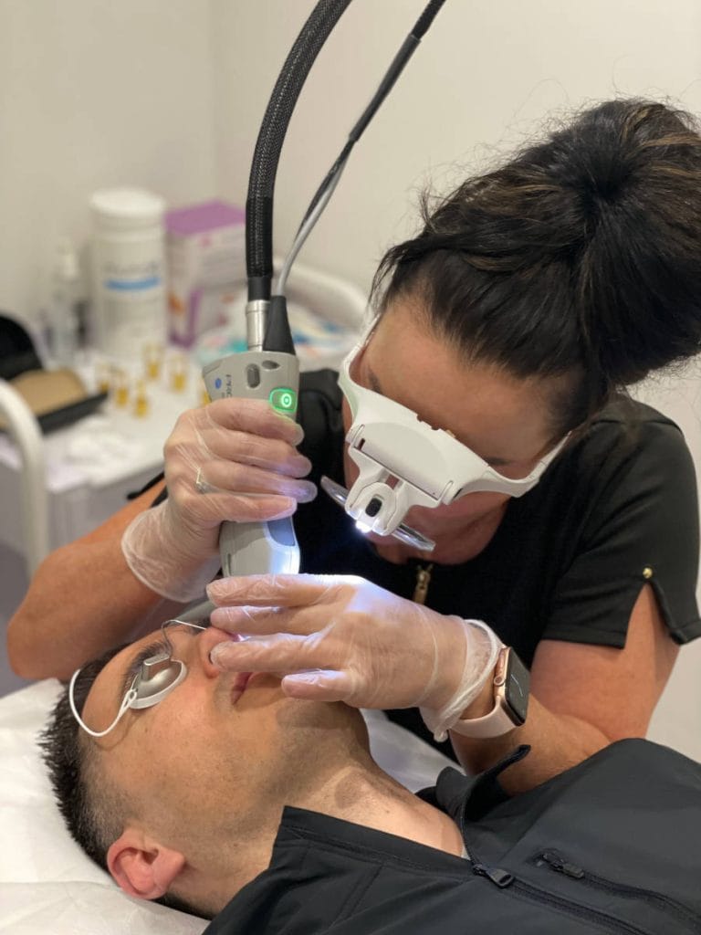 Laser Thread Vein Removal