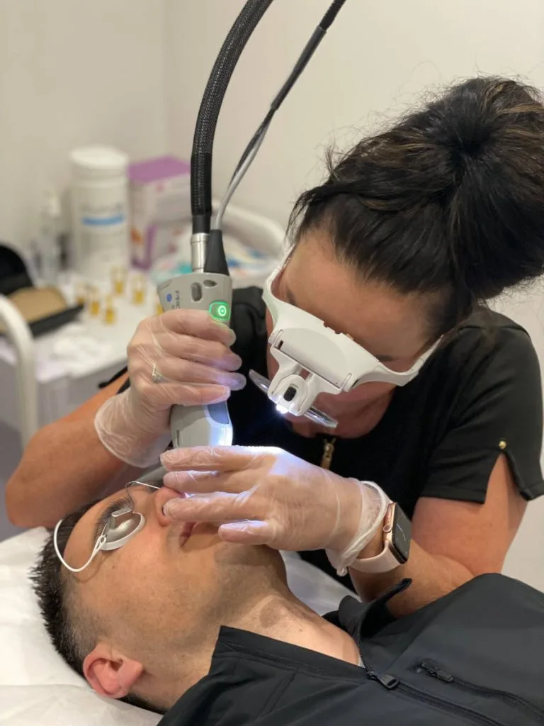Laser Thread Vein Removal