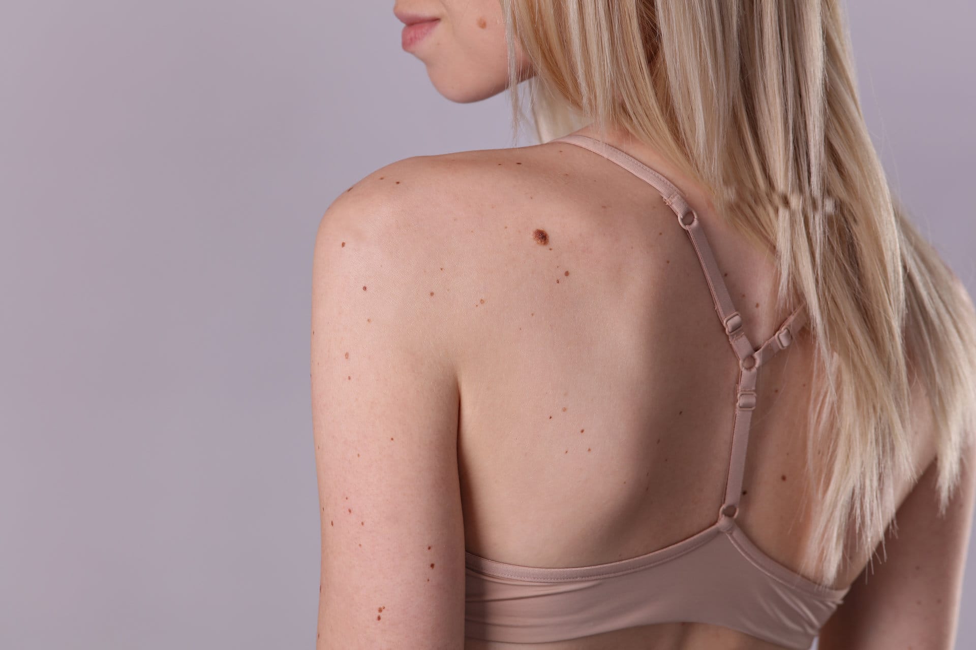 laser results