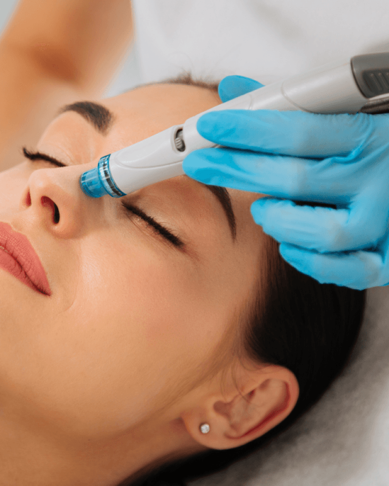 Transform Your Skin With A Summer HydraFacial